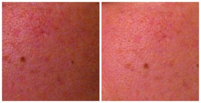 Before and After