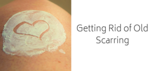 Getting Rid of Old Scarring