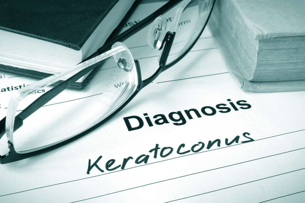 diagnosis keratoconus