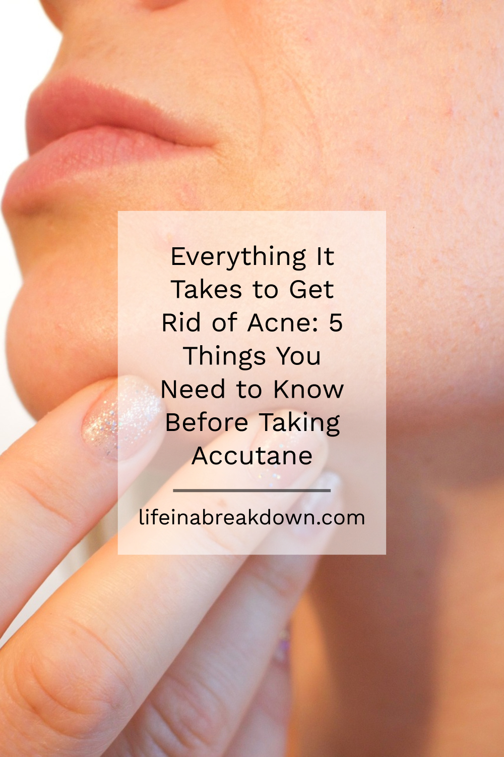 Everything It Takes to Get Rid of Acne_ 5 Things You Need to Know Before Taking Accutane