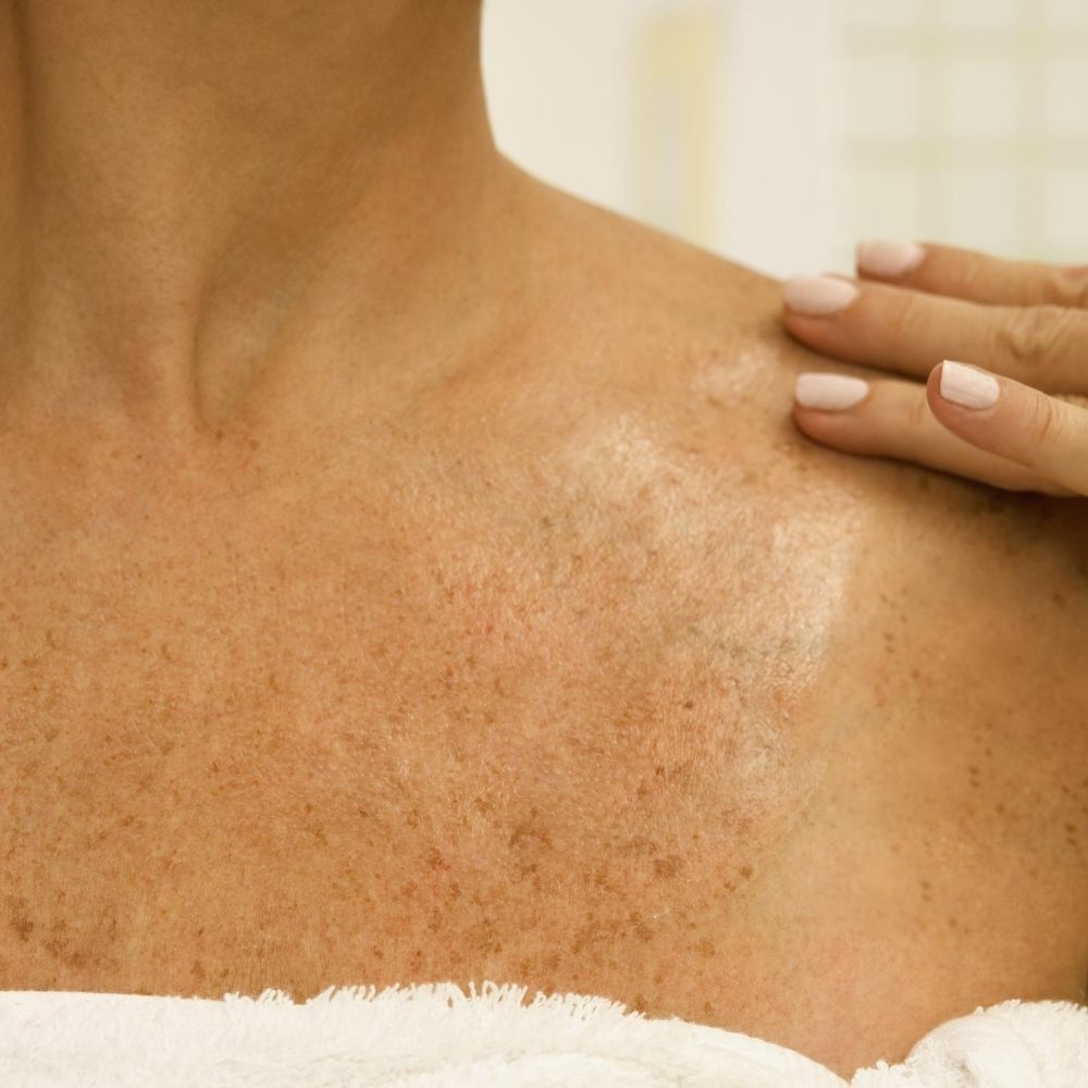 skincare of the neck