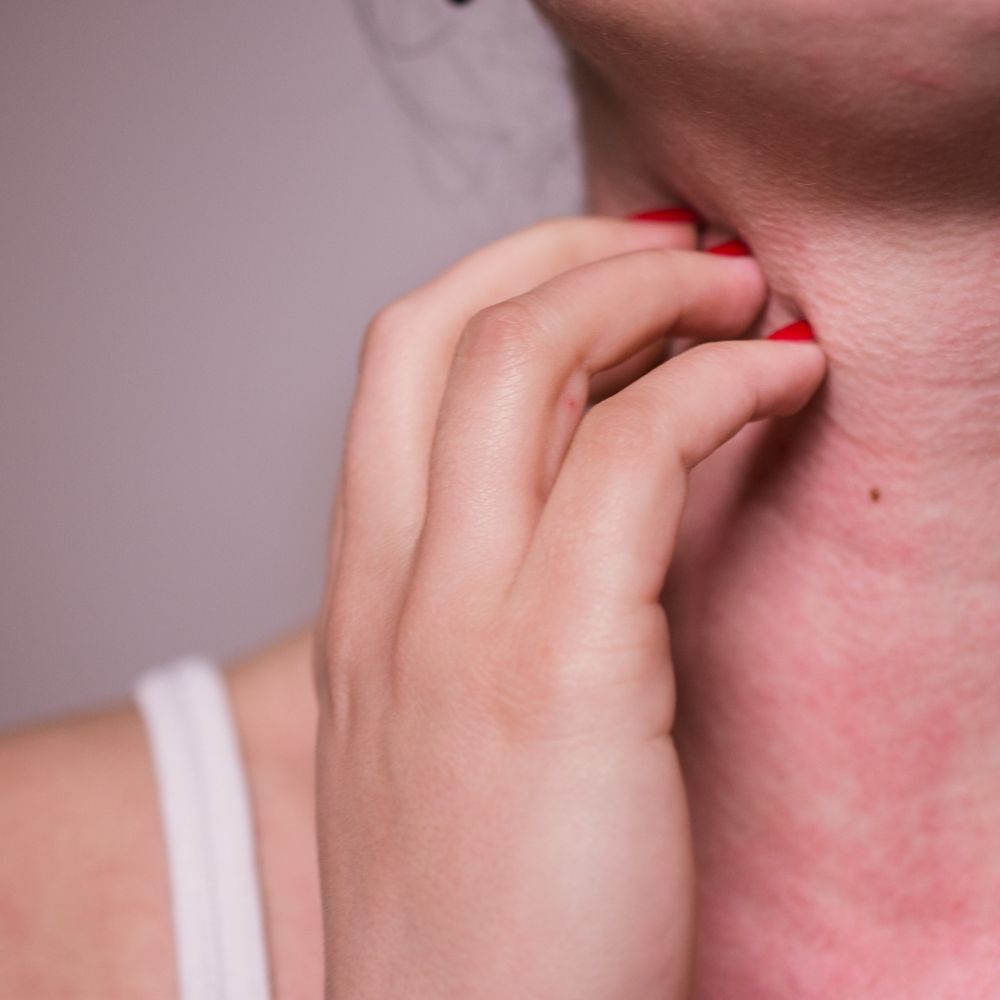 person scratching at a rash on neck which could be allergy related