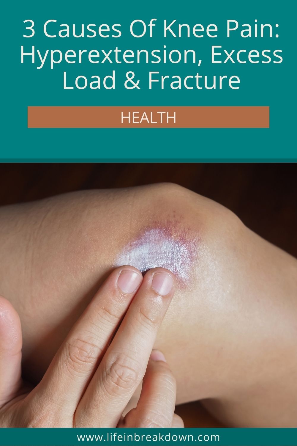 Are you wondering what could be causing your knee pain? Then here are 3 things that could be causing that painful joint.