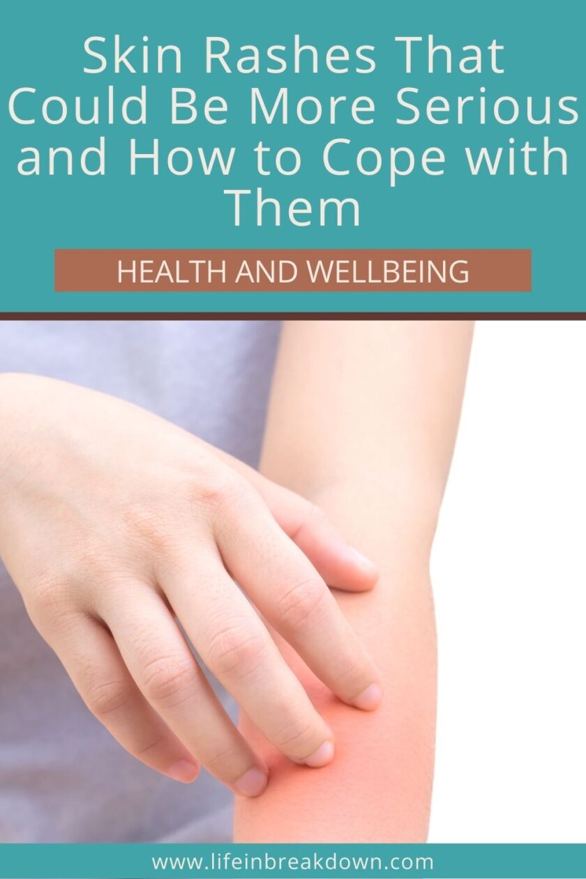 Are you worried about a skin rash you may be having? Here are some causes of them and how you can cope with them.