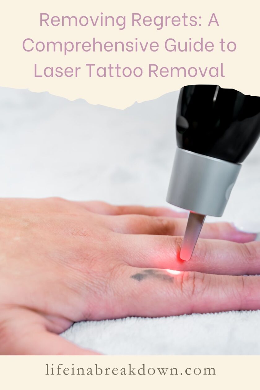 Are you wondering what it is like to get a tatto removed? Then this guide goes into some of the things you should know.