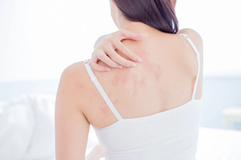Woman itching her back