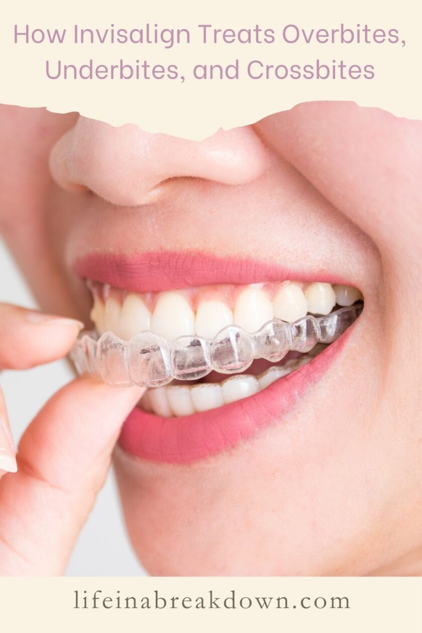 Are you wondering if Invisalign is right for you? Then here is some insight into how it treats overbites, underbites and crossbites which might help.