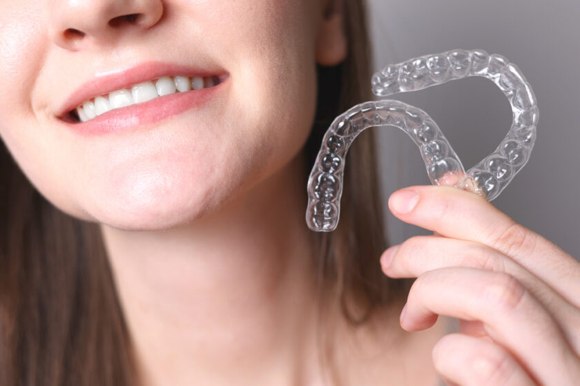 Aligners for aligning teeth