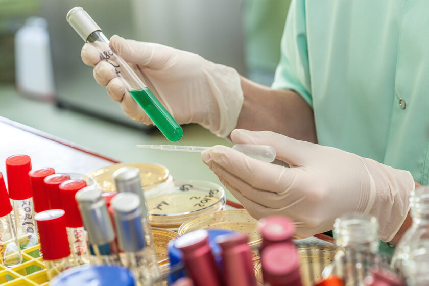 A person wearing gloves holds a green liquid-filled test tube and a pipette in a laboratory setting. Various other test tubes, some with red caps, and petri dishes with labeled culture samples are visible in the background.