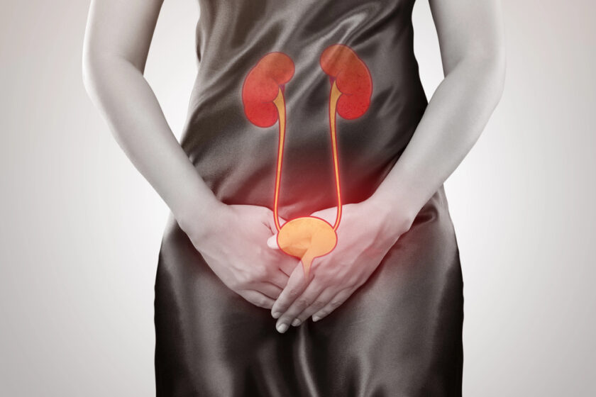 A person in a black dress holds their lower abdomen, with an illustration of kidneys, ureters, and bladder superimposed, highlighting the urinary system and indicating discomfort or pain in that area.