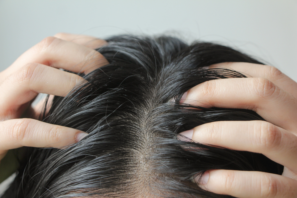 A close-up of a person's scalp with dark hair parted in the middle. Both hands are gently spreading the hair, revealing the scalp beneath.