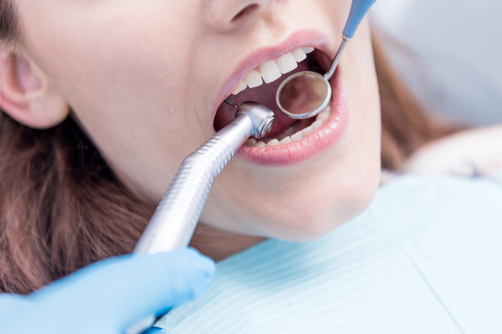 A close-up of a person at the dentist, with their mouth open as a dental mirror and tool are used by a gloved dentist.