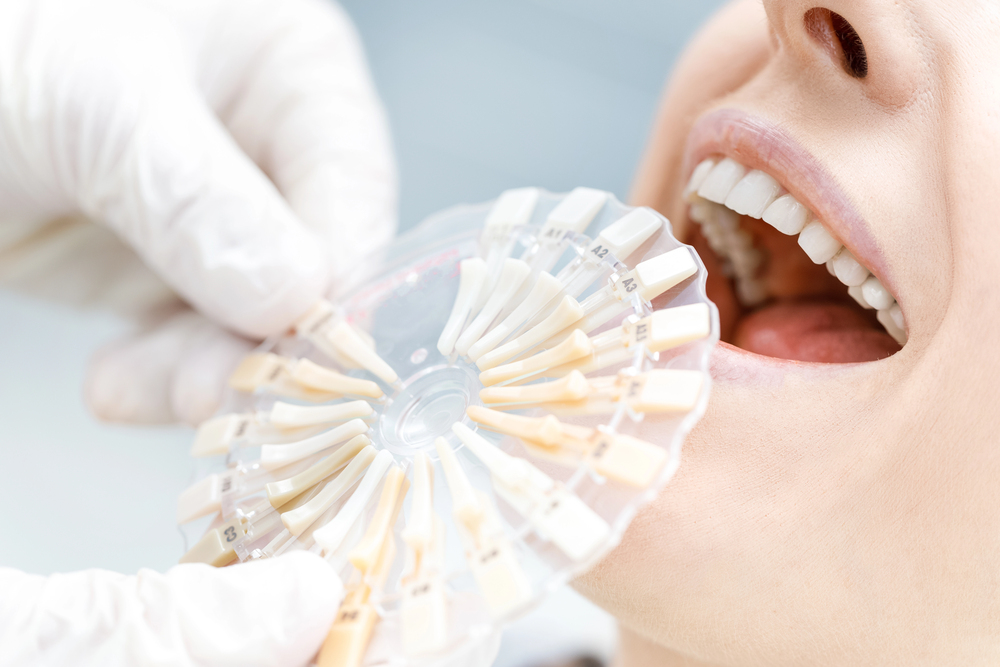 A dentist holding a tooth shade guide next to a patient's teeth.